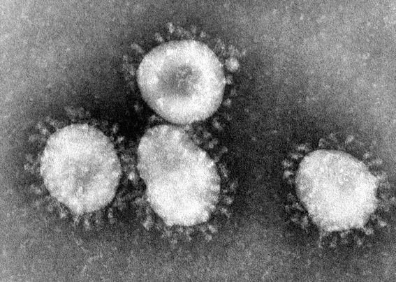 Coronavirus have a "crown-like" structure, image via the Ecohealth Alliance