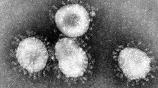 Coronavirus have a "crown-like" structure, image via the Ecohealth Alliance
