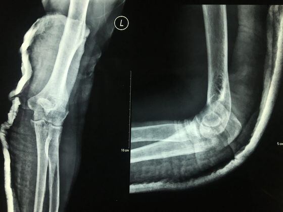 x-ray, injury